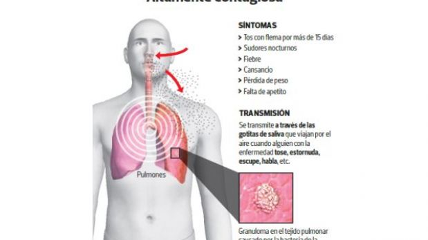 Vitamina C mata bacterias de la tuberculosis resistente a fármacos