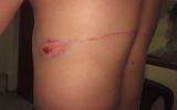 Médicos serumistas fueron azotados y golpeados por ronderos en Cajamarca