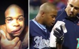 Le cae bola de béisbol en la cara a 145km/h y se hace un selfie