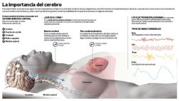 Hay que distinguir entre el estado de coma y la muerte cerebral