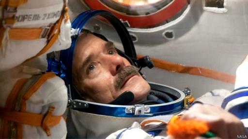 Al regresar de la ISS, Hadfield corría el riesgo de romperse la cadera, por la pérdida de densidad ósea.