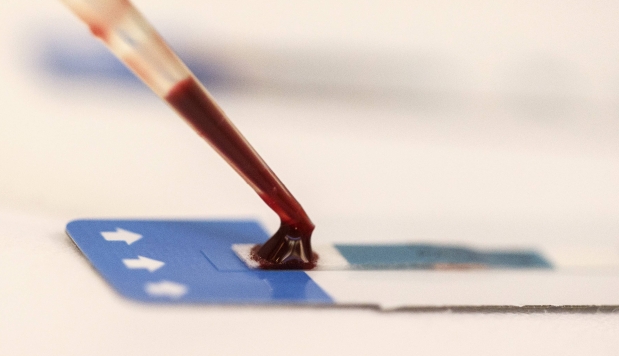 Descubren cómo producir plaquetas artificialmente en la sangre