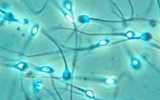 Investigan capacidad protectora del semen de hombres con VIH