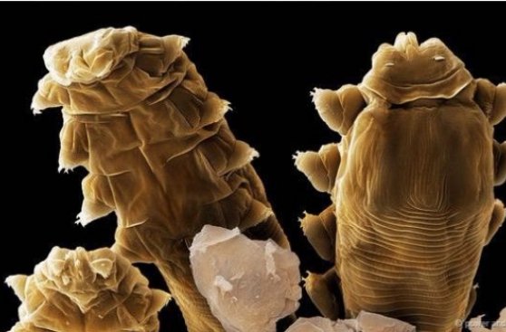Estos ácaros microscópicos viven en nuestra cara