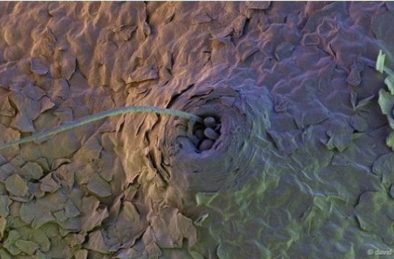 Estos ácaros microscópicos viven en nuestra cara