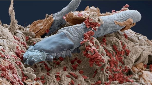 Así se ve el ácaro desde muy cerca, a través de un microscopio electrónico de barrido. (Foto: BBC Mundo)