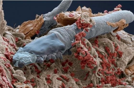 Estos ácaros microscópicos viven en nuestra cara