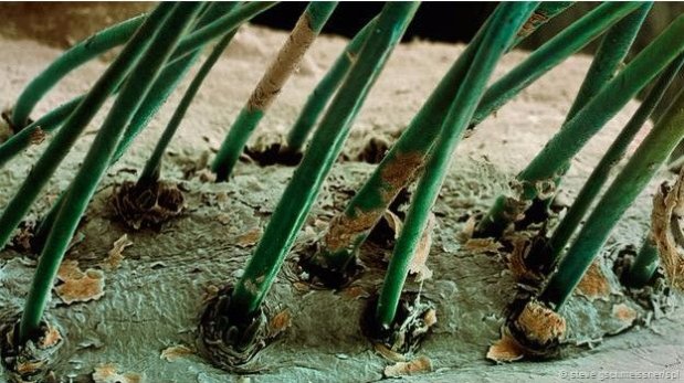 Estos ácaros microscópicos viven en nuestra cara