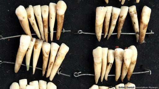 Estos dientes estuvieron una vez en la boca de varios soldados. (Foto: British Dental Association Museum)