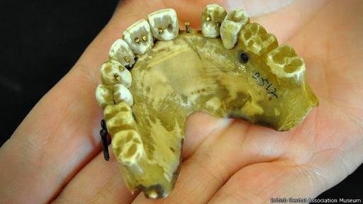 Los técnicos experimentaron con las fijaciones. (Foto: British Dental Association Museum)