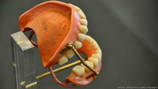 El siguiente gran progreso fue el reemplazo del marfil por la vulcanita a la hora fabricar las bases de las dentaduras. (Foto: British Dental Association Museum)