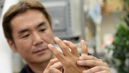 Shintaro Hayashi, especialista en prótesis, chequea el meñique de silicona de un exmiembro de la Yakuza.