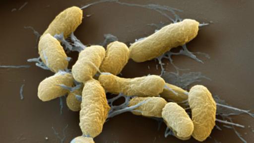 La peste bubónica es la variedad más común de la enfermedad y de la que más casos se han registrado en América Latina.