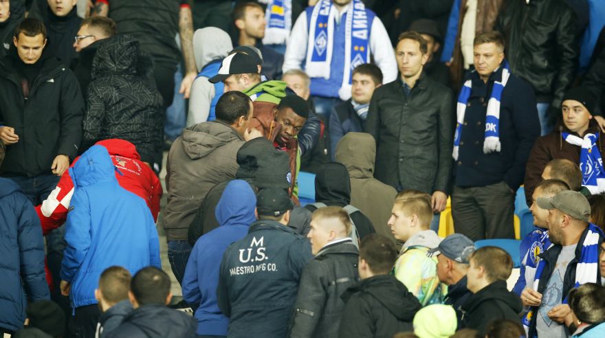 Football - Dynamo Kiev v Chelsea - UEFA Champions League Group Stage - Group G - NSK Olimpiyskyi Stadium, Kiev, Ukraine - 20/10/15Fan looks on after being attacked in the crowd Action Images via Reuters LivepicEDITORIAL USE ONLY.