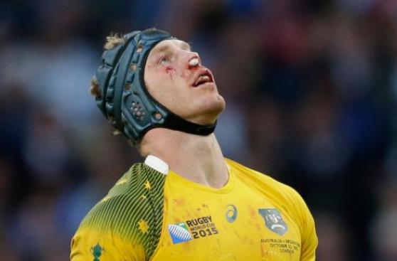Rugby: así quedó rostro de figura de Australia ante Argentina