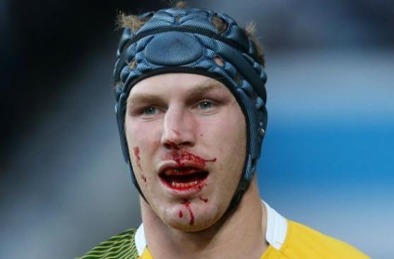 Rugby: así quedó rostro de figura de Australia ante Argentina