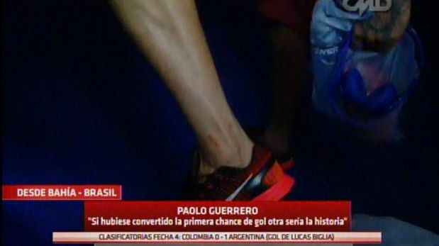 Paolo Guerrero mostró las evidencias del juego fuerte de la defensa de Brasil en la victoria sobre Perú. (Captura CMD)