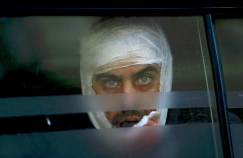 A wounded Ukrainian soldier looks through a windows as he arrives to a hospital in Artemivsk, February 18, 2015. Government forces started pulling out of a town in eastern Ukraine on Wednesday after a fierce assault by Russian-backed separatists which Europe said violated a crumbling ceasefire.   REUTERS/Gleb Garanich (UKRAINE  - Tags: HEADSHOT SOCIETY POLITICS TPX IMAGES OF THE DAY CIVIL UNREST CONFLICT)