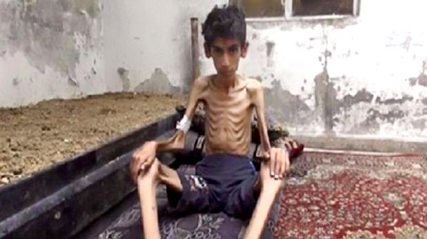 Un niño muere de hambre en Madaya, Siria. (Foto: AP)