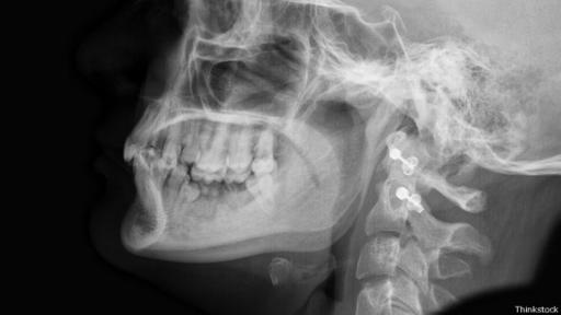 Los humanos somos los únicos cuya mandíbula termina en una protuberancia. (Foto: Thinkstock)