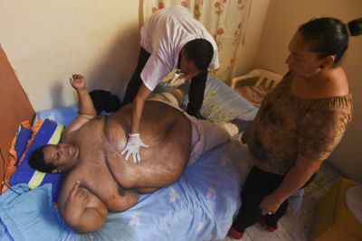Oscar Vasquez Morales (L), 44, receives a massage at his home on March 19, 2016, in Palmira, Colombia. Vasquez, who weighs about 400 kilos and is considered the fattest man in the country, is expected to lose 300 kilos in the next 3 or 4 years due to a medical treatment.  AFP PHOTO / LUIS ROBAYO