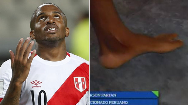 Así quedó tobillo de Jefferson Farfán tras el Perú vs Venezuela