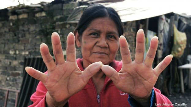Agistina Joaquín, la más pobre de Ciudad de México. (Foto: Luis Alberto Castillo)