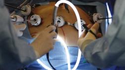 Diabetes: quieren que cirugía gástrica sea tratamiento estándar