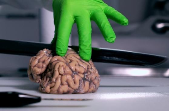 ¿Qué pueden hacer con tu cerebro si decides donarlo?