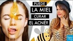 Mitos y verdades sobre la miel como solución contra el acné