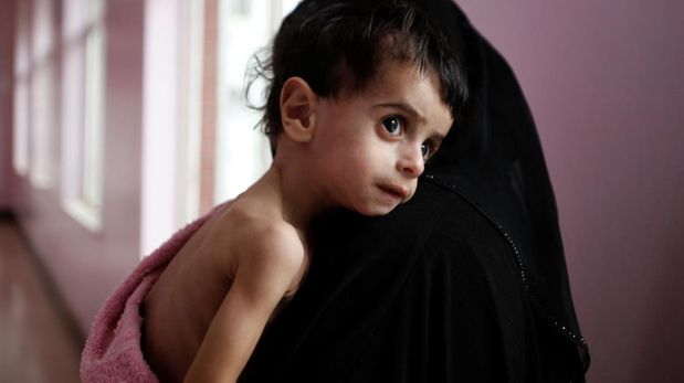 La mirada perdida de un chico en brazos de su madre en el hospital de Sanaa. (Foto: Reuters / Khaled Abdullah)