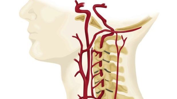 El cuello es una zona muy delicada por donde pasan arterias que conectan el cerebro con el cuerpo. (Foto: SCIENCE PHOTO LIBRARY)