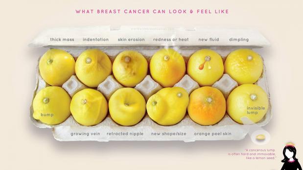 Cáncer de mama: Los limones que ayudan a entender las señales