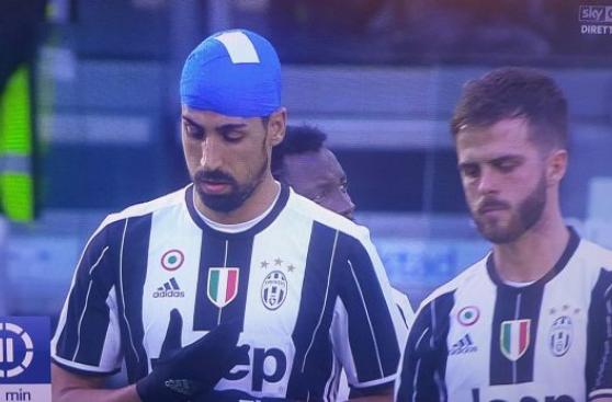 Sami Khedira utilizó extraño vendaje en partido de Serie A