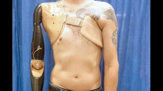 Crean prótesis de brazo que detecta señales de médula espinal