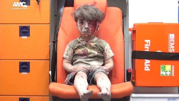 Lejos de los suburbios de Damasco donde viven Bashar, Asma y sus tres hijos, el pequeño Omran Daqneesh sobrevivió hace unos meses a un ataque aéreo contra un barrio opositor. (Foto: Alepo Media Center)