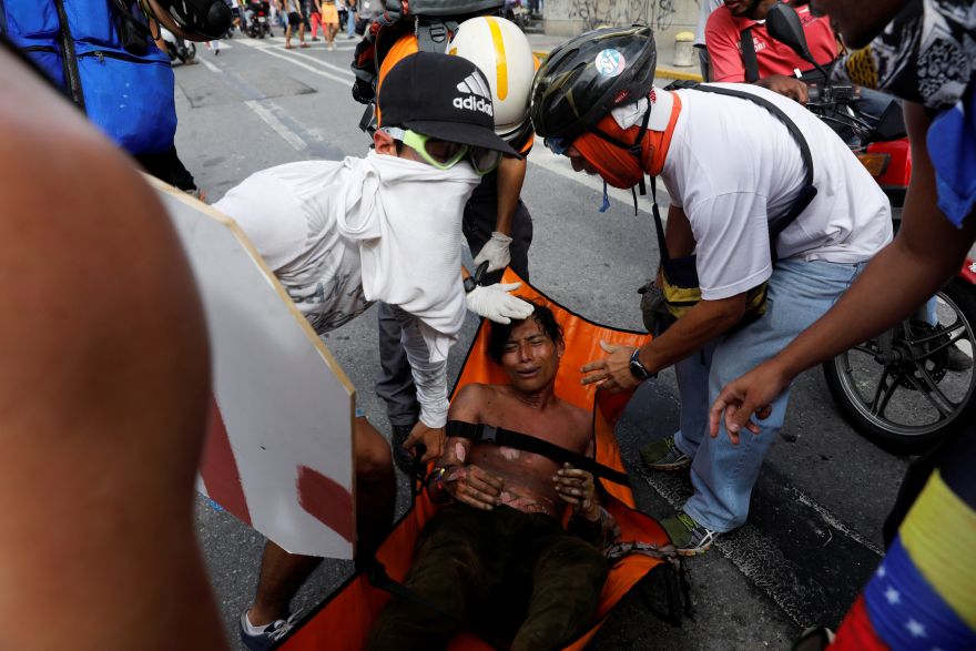 ATTENTION EDITORS - VISUAL COVERAGE OF SCENES OF INJURY OR DEATHAn injured opposition supporter is helped by others during a rally against President Nicolas Maduro in Caracas, Venezuela, May 3, 2017. REUTERS/Carlos Garcia Rawlins TEMPLATE OUT