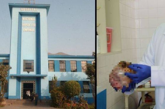 Tumor de casi dos kilos fue extirpado a bebe con 14 días de nacida