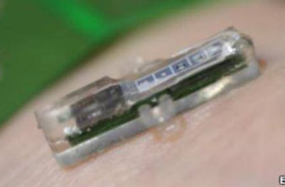 Laboratorio bajo la piel: implante electrónico realiza análisis constantes de sangre