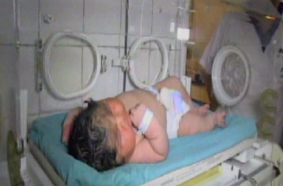 España: bebe de más de 6 kilos es el más grande nacido por parto natural