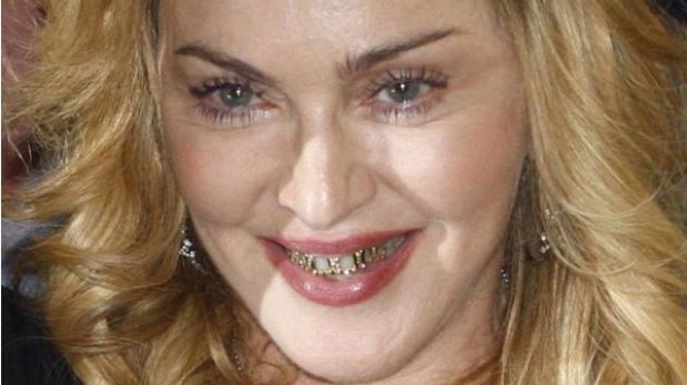 Madonna lució oro y diamantes en sus dientes 