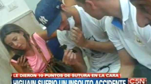 FOTOS: Gonzalo Higuaín ahora luce diez puntos de sutura en el rostro tras sufrir accidente