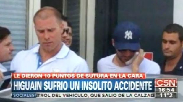 FOTOS: Gonzalo Higuaín ahora luce diez puntos de sutura en el rostro tras sufrir accidente