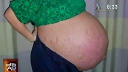 Mujer iraquí que ya tiene siete hijos está embarazada de trece bebes