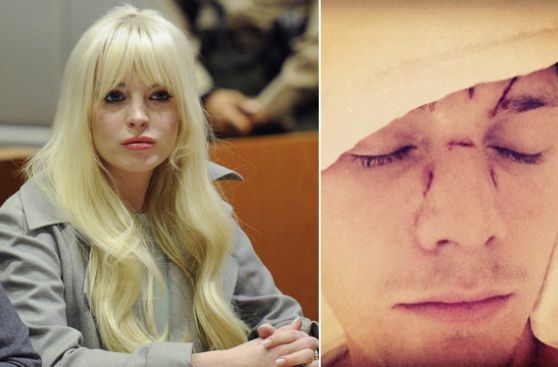 Hermano de Paris Hilton demandará a Lindsay Lohan por golpiza