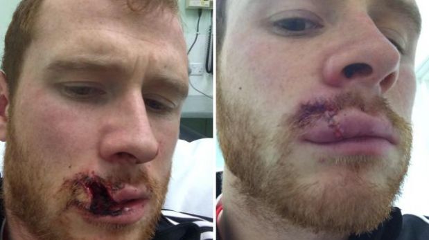 Defensor escocés sufrió tremendo corte tras violento choque con un rival