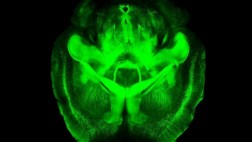 Un gen relaciona la materia gris cerebral con la inteligencia