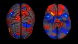 Los hombres tienen mayor volumen cerebral que las mujeres