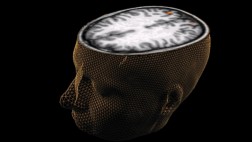 Australianos quieren desarrollar un cerebro biónico