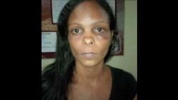 Venezuela: Mujer masacrada por policía es acusada de agresión